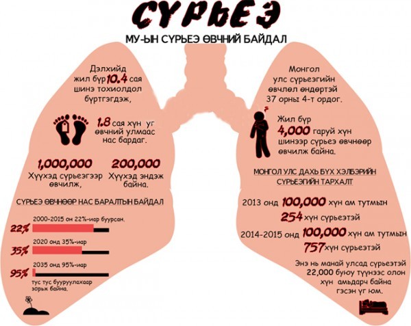 Сүрьеэ нь нийт халдварт өвчний 10 хувийг эзэлдэг